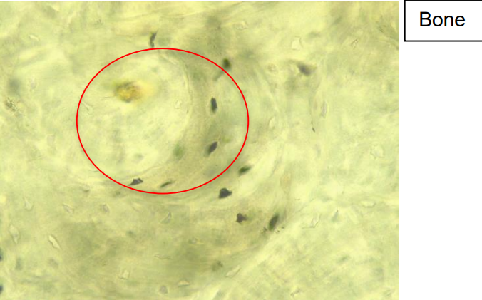 <p>Chacteristics: Osteons (tube of capillaries and nerves), osteocytes, and lacunae</p><p>Function: Protection and connection point</p><p>Location: bone</p>
