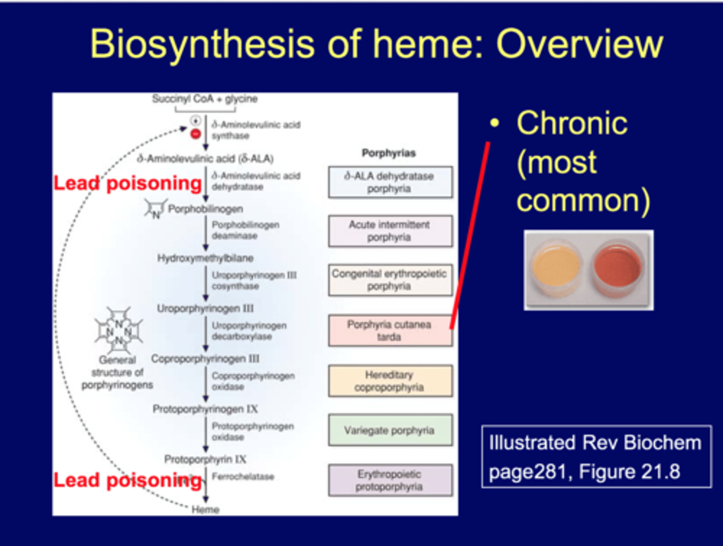 <p>1. δ-aminolevulinic acid dehydratase (ALAD) (2nd step)<br>2. Ferrochelatase (last step), inhibits moving of iron into the ring of heme<br><br>-porphyria cutanea tarda-chronic and most common<br>- causes brownish urine</p>