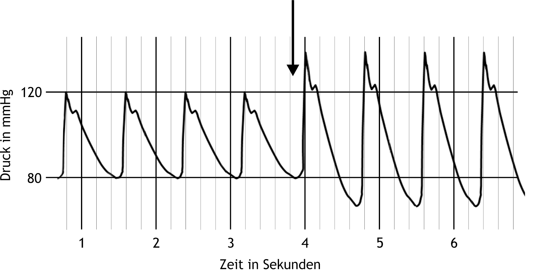 <p>38. In the figure below, pressure measurements in the ascending aorta are shown from a model of the circulatory system that allows individual parameters to be varied independently.</p><p>Which change in one of the listed parameters is most likely made at the time indicated by the arrow?</p><p>A. Stroke volume is decreased.</p><p>B. Peripheral resistance is decreased.</p><p>C. The diastolic time fraction is decreased.</p><p>D. Aortic compliance is decreased.</p><p>E. Heart rate is increased.</p>