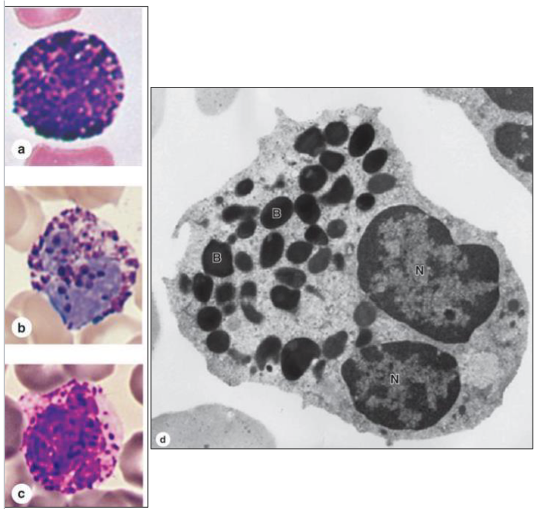 <p>What type of cell is seen here?</p>