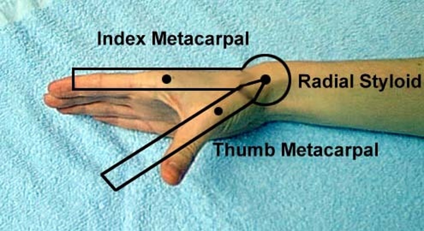 <p>fulcrum: lateral scaphoid/radial styloid process<br>proximal: lateral midline of 2nd MC<br>distal: dorsal midline of 1st MC<br><br>* goniometer forms V shape<br>* mid position</p>