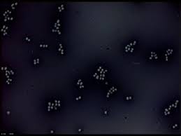 <p>Staining procedure that uses an acidic dye, stains the background dark, uses live culture</p>