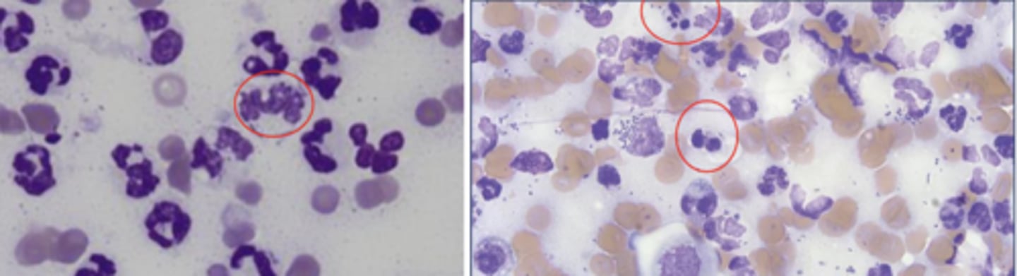 <p>What kind of inflammation is this?</p>