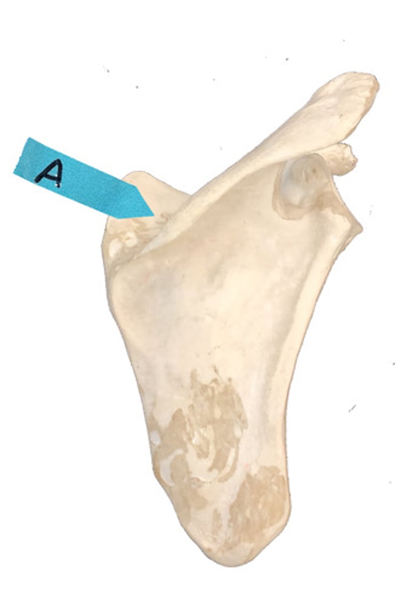 <p>Identify this bone marking.</p>
