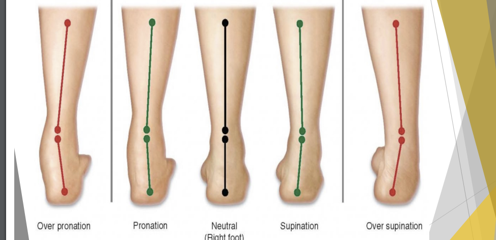 <p>Over Pronation ←→ Over Supination</p>