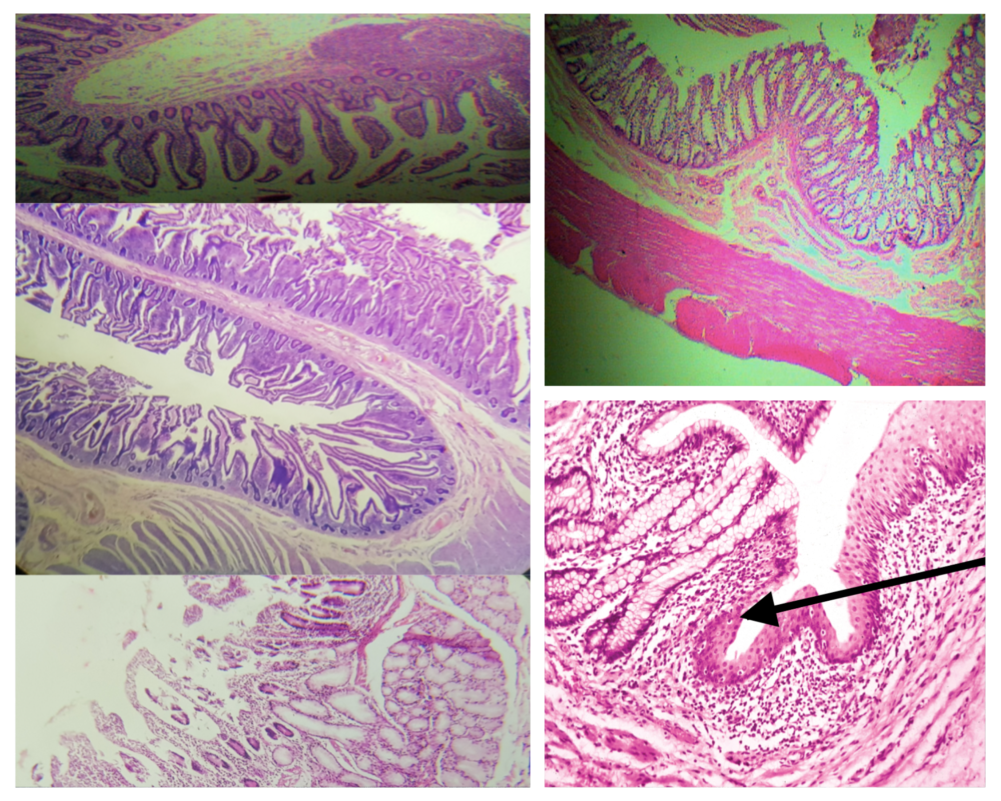 <p>Meissner’s plexus</p>