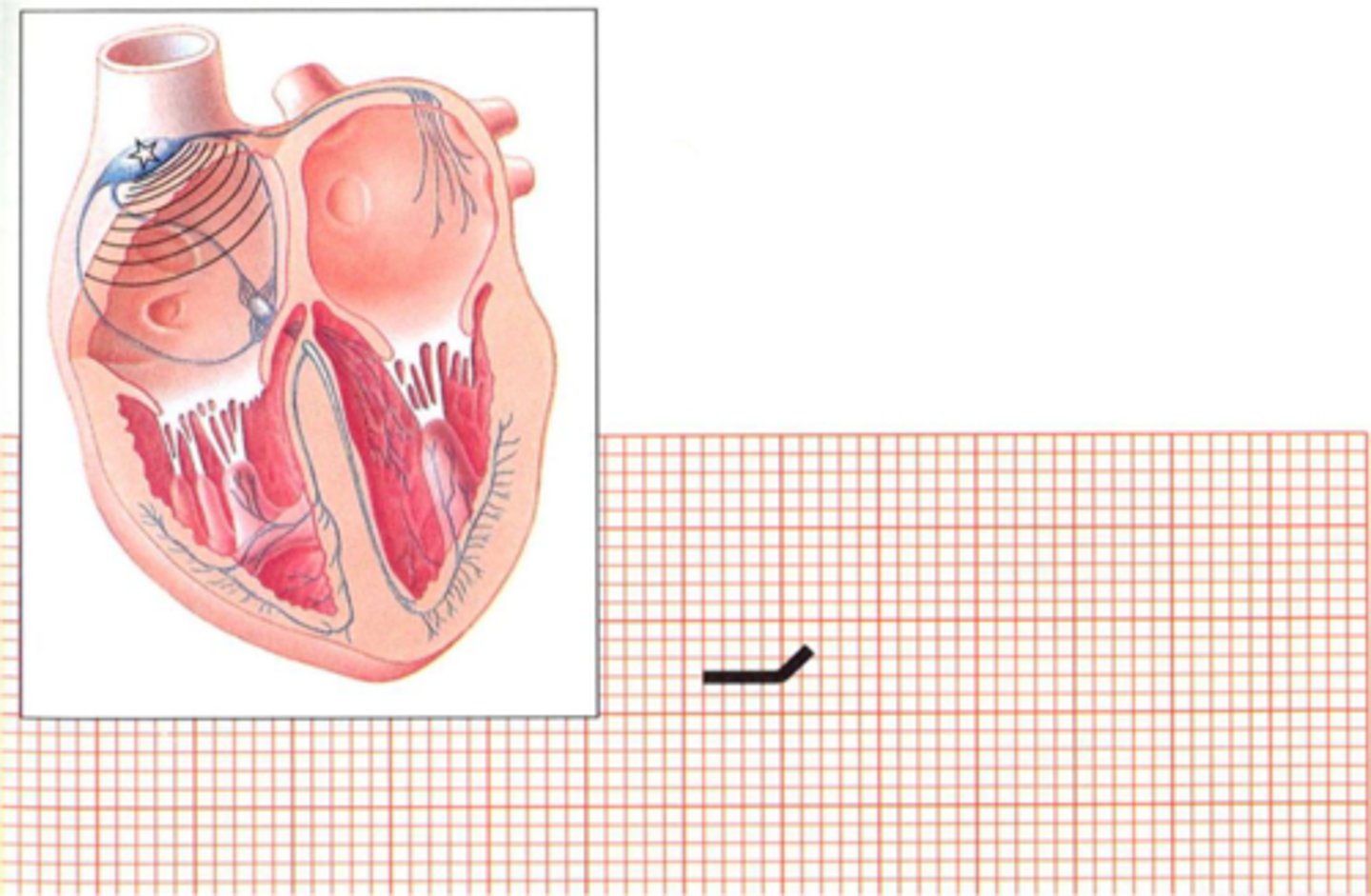 <p>Atrial depolarisation proceeds from right, through the internodal tracts to left through Bachmann's bundle</p>