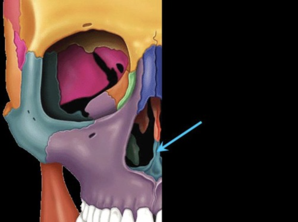 <p>forms the inferior portion of the nasal septum</p>