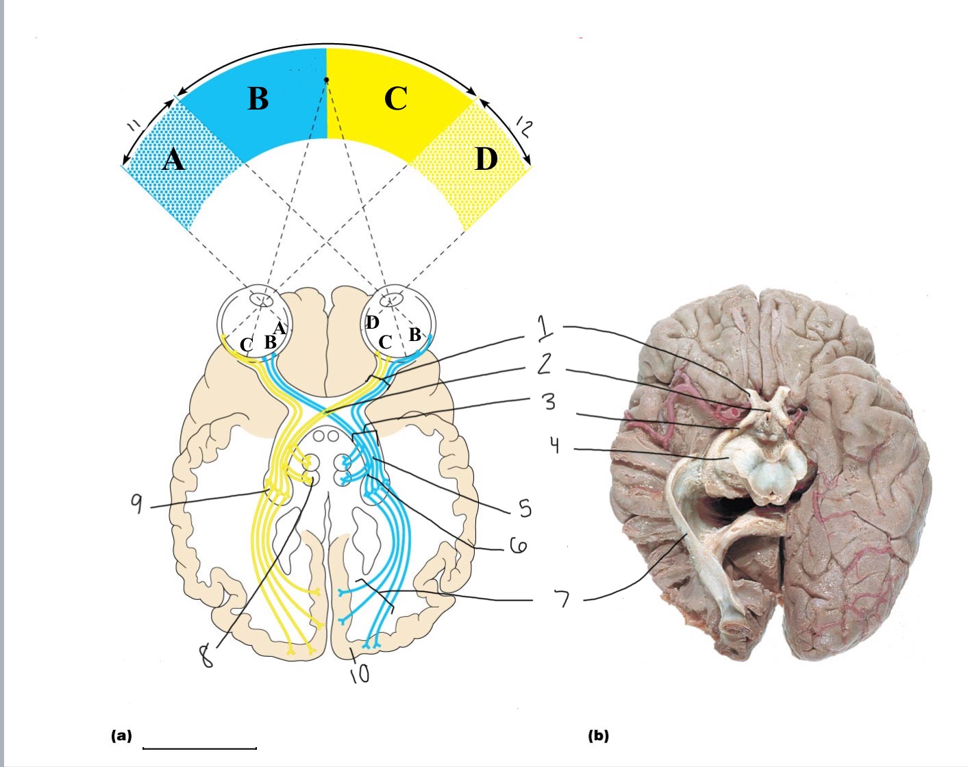 <p>11</p>