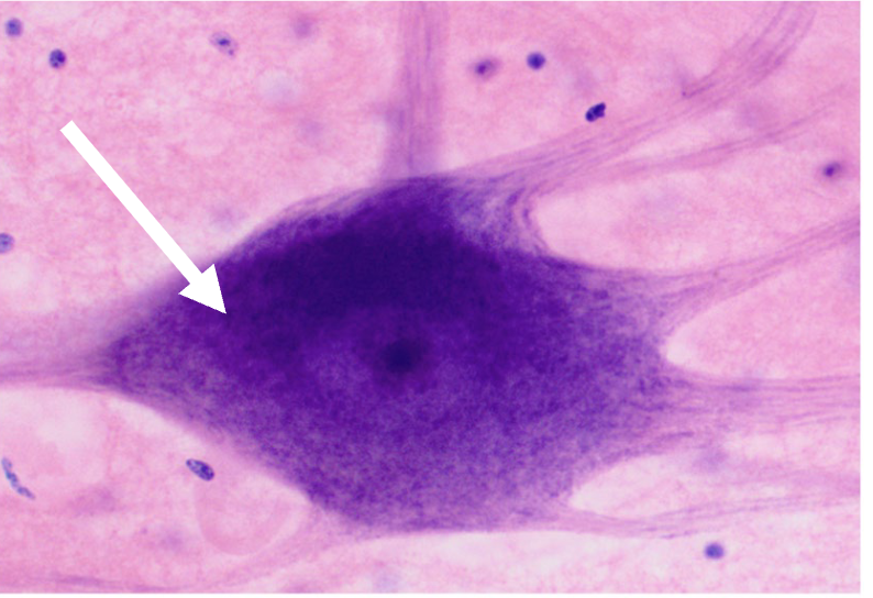 <p>What is the arrow point at?</p>
