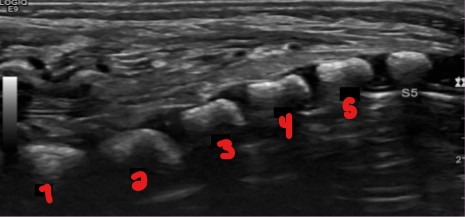 <p>Label the vertebrae if ‘S5’ is the only one still labeled here. </p>