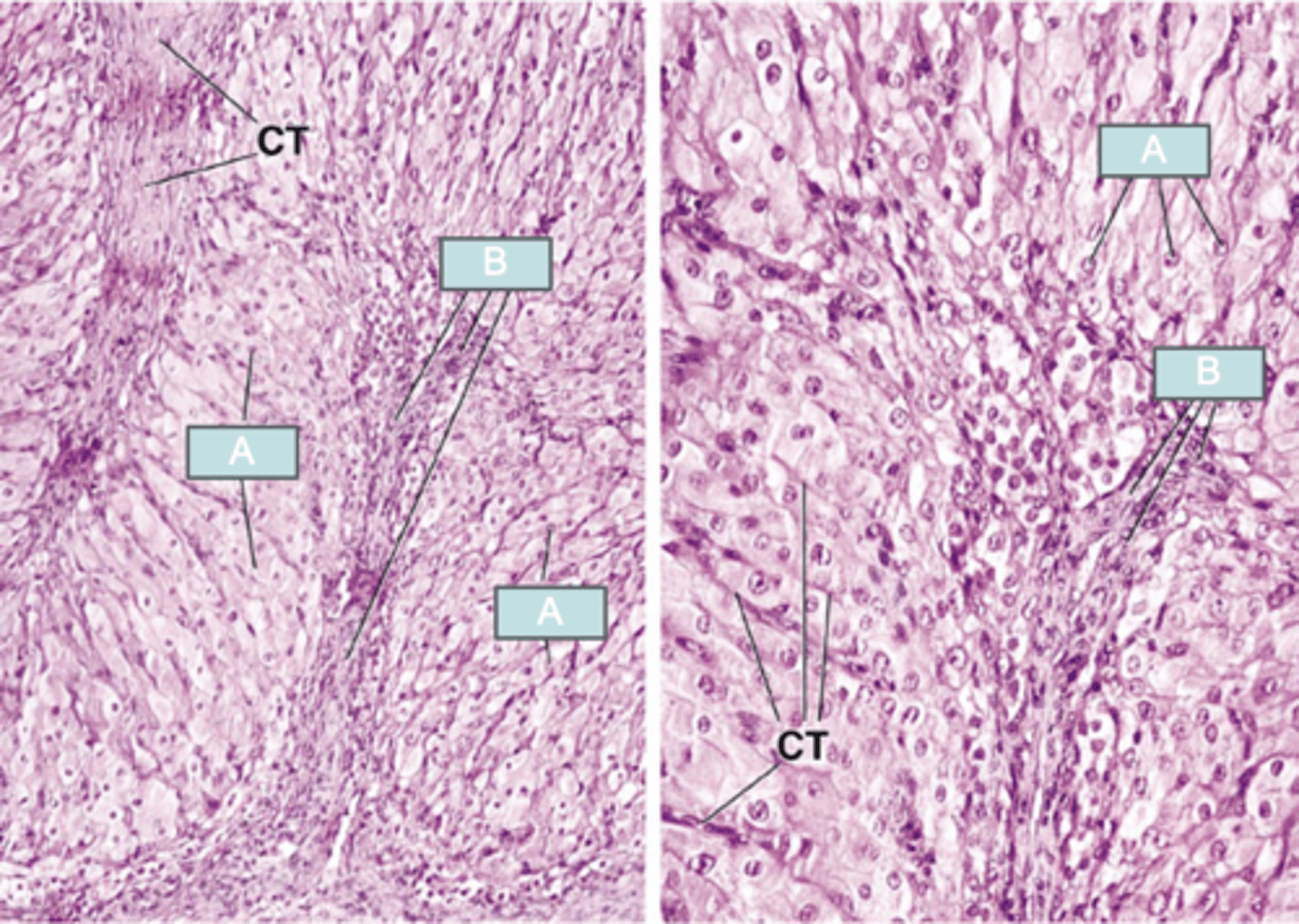 <p>What corpus luteum cell type is A ?</p>