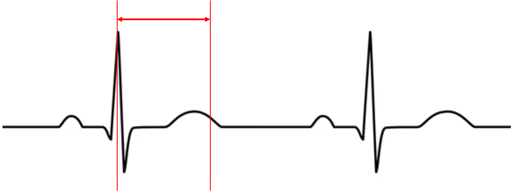 <p>what does this represent?</p>