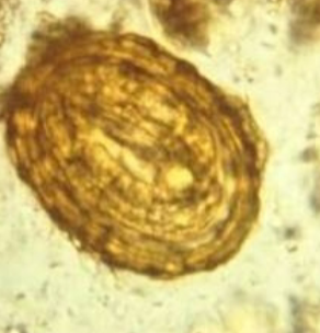term image