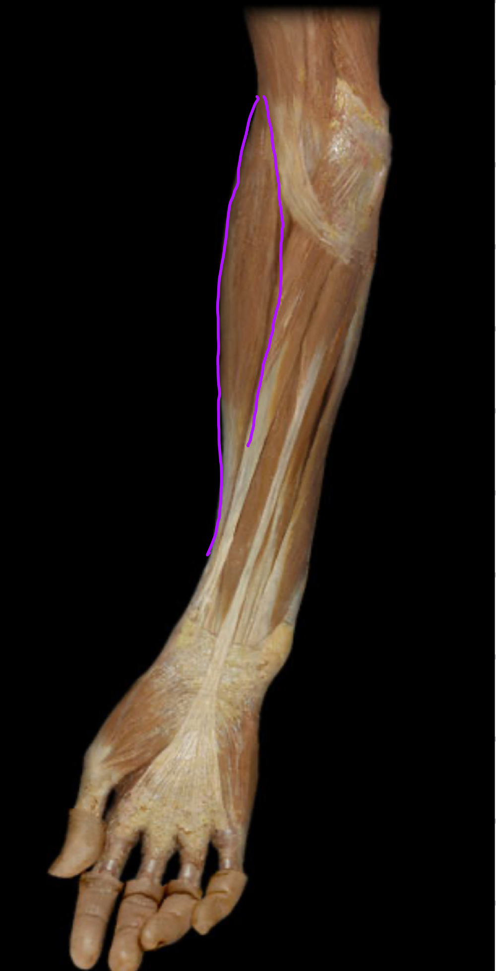 <p>Innervation?</p>