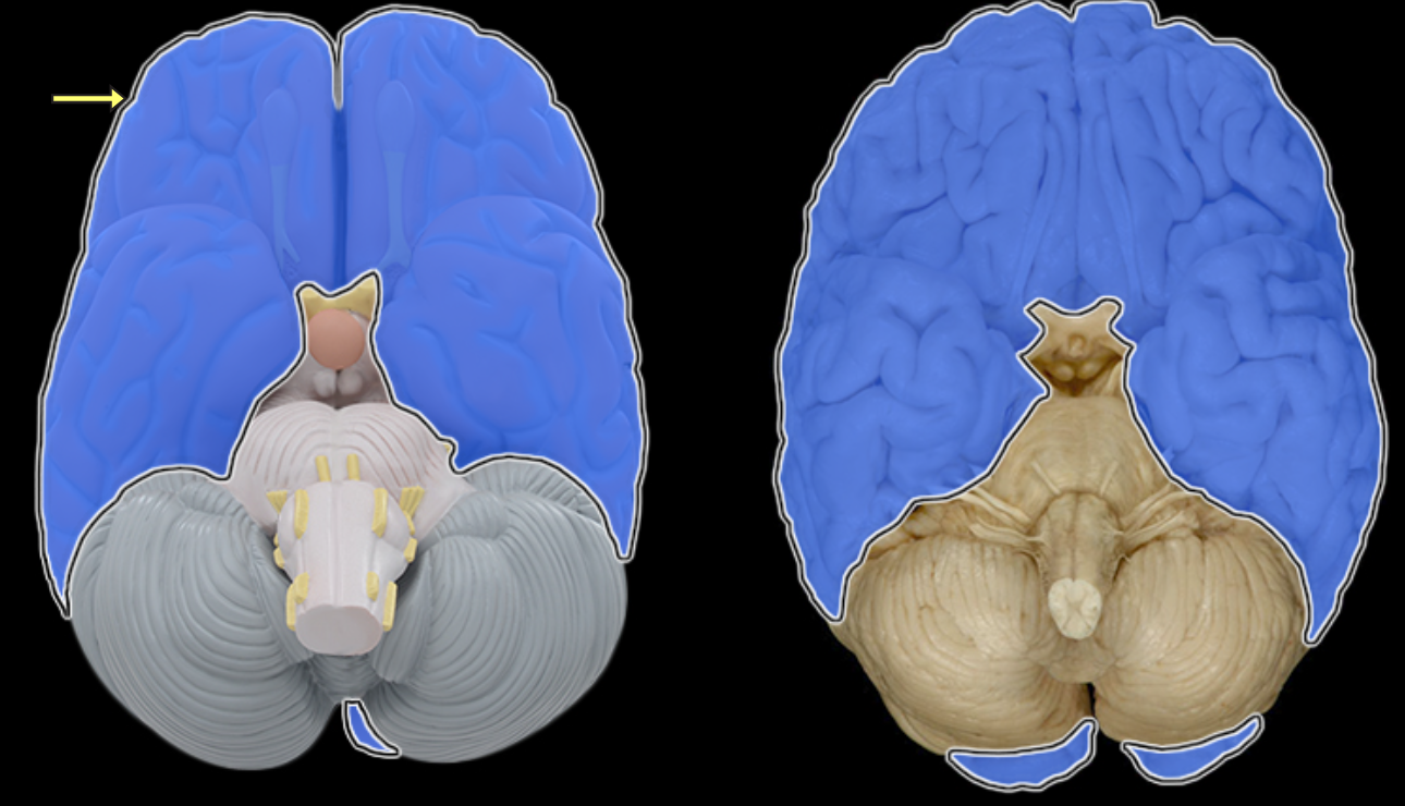 <p>Location:</p><ul><li><p>Rostral portion of brain</p></li></ul><p>Description:</p><ul><li><p>Includes two large cerebral hemispheres separated by longitudinal fissure</p></li><li><p>Hemispheres connected by corpus callosum</p></li><li><p>Surface gray matter of each hemisphere is known as cerebral cortex</p></li><li><p>Within each hemisphere there is a core of white matter</p></li><li><p>Additional masses of gray matter located within cerebrum include basal nuclei</p></li></ul><p>Comment:</p><ul><li><p>Rostral = toward the nose (Latin: rostrum = beak)</p></li></ul><p></p>