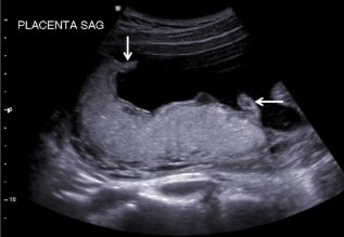 <p>What does the arrow point to?</p>