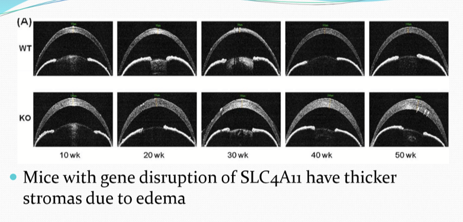<p>An ion transport encoding gene, SLC4A11, disrupting the function of a putative NBC co-transporter</p>