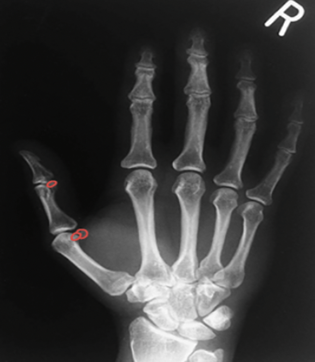 <p>What structure is highlighted?</p>