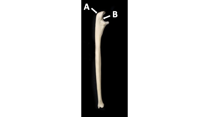 <p>What type of bone marking is B? (hint: it’s in the brachial region)</p>