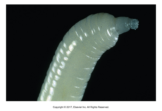 <p>Acanthocephalans are also called what?</p>