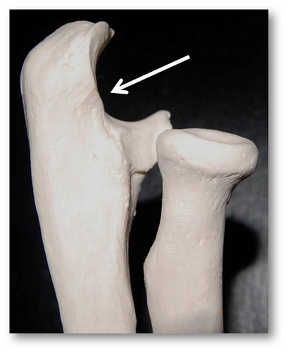 <p>Name this specific part of the ulna.</p>