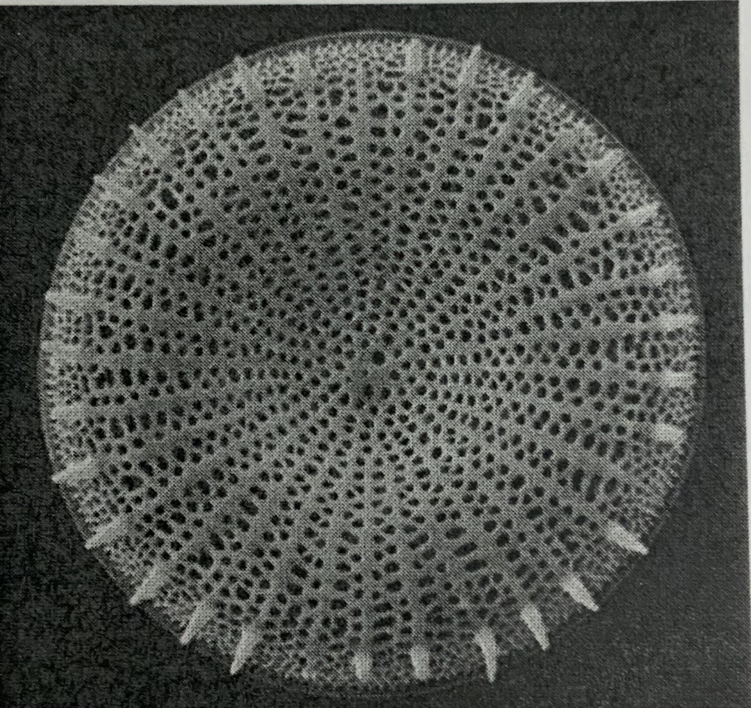 <p>What shape of diatoms are shown below ? </p>
