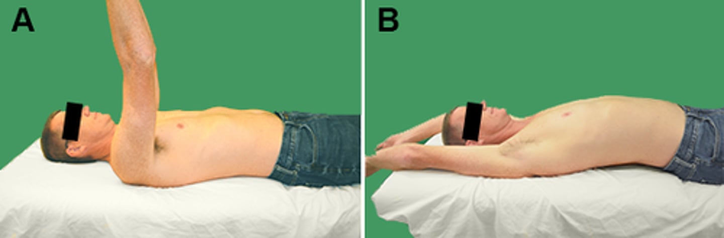 <p>A patient performs the movement with the starting and ending positions shown in photographs A and B, respectively. Which of the following options BEST explains the end result demonstrated in photograph B?</p><p>1. Scapular elevation and downward rotation motions are limited.</p><p>2. Pectoralis major muscles are actively insufficient.</p><p>3. Glenohumeral joint extension range of motion is restricted.</p><p>4. Latissimus dorsi muscles are passively insufficient.</p>