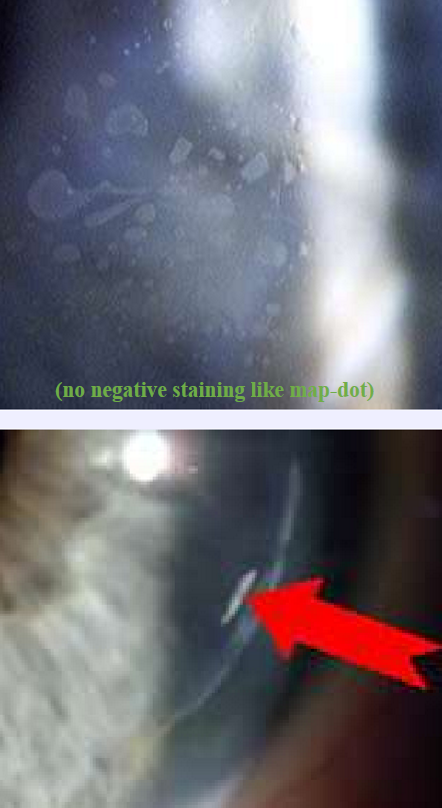 <p>What condition is this?</p>