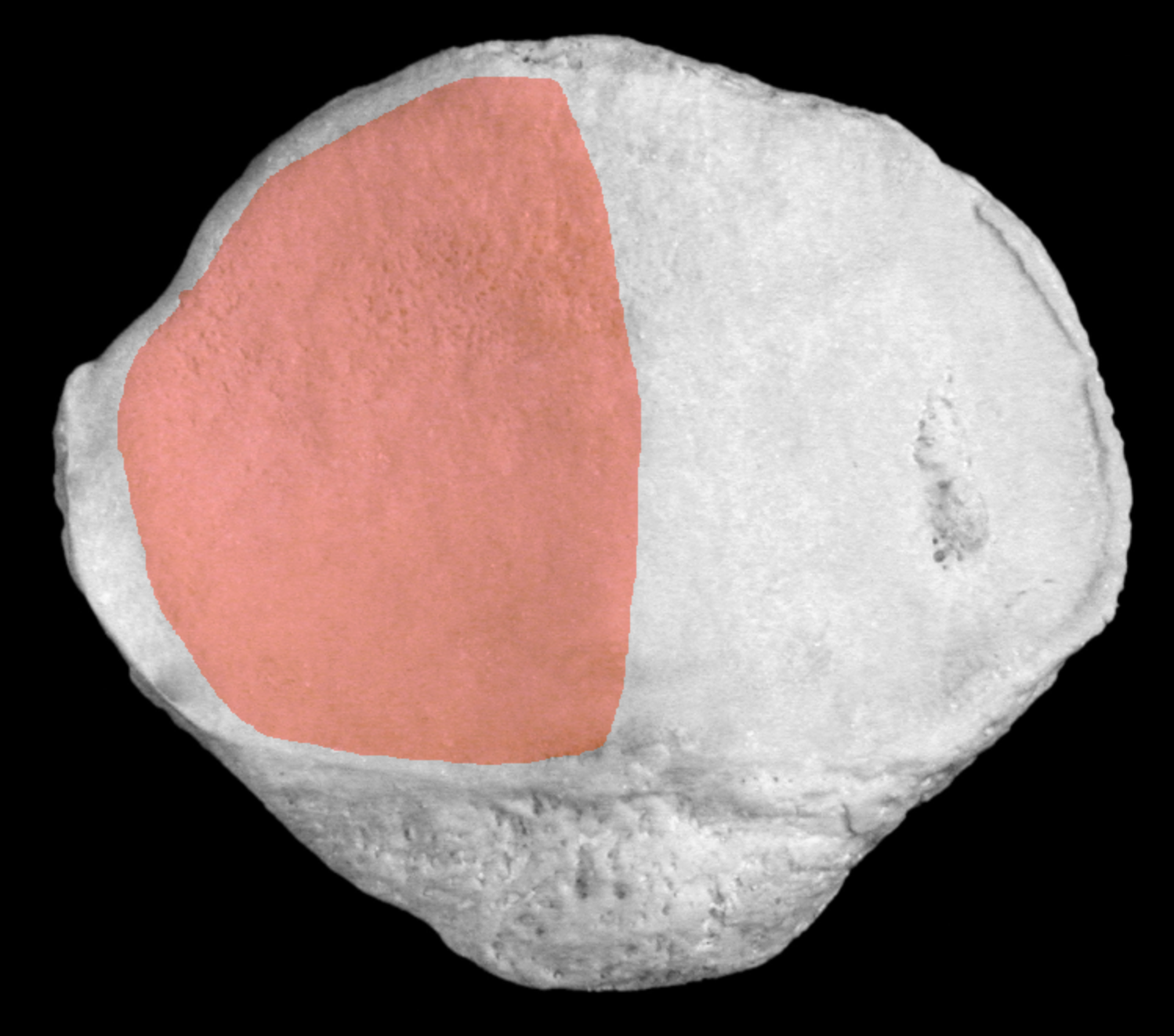 <p>larger oval on posterior patella </p>