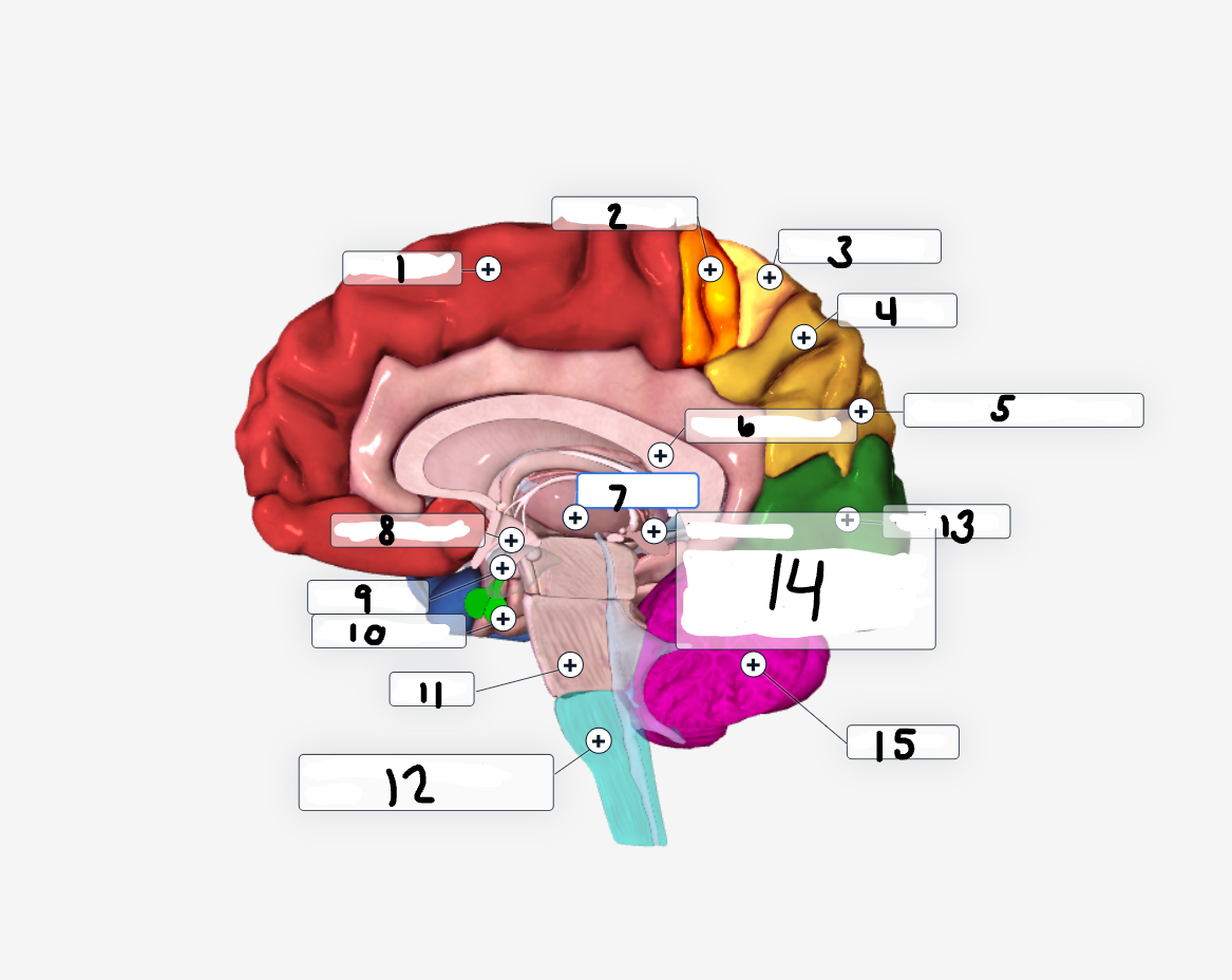 <p>Label the image</p>