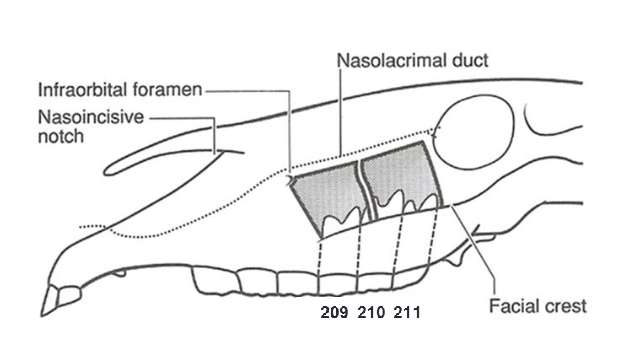 <p>maxillary sinuses</p>