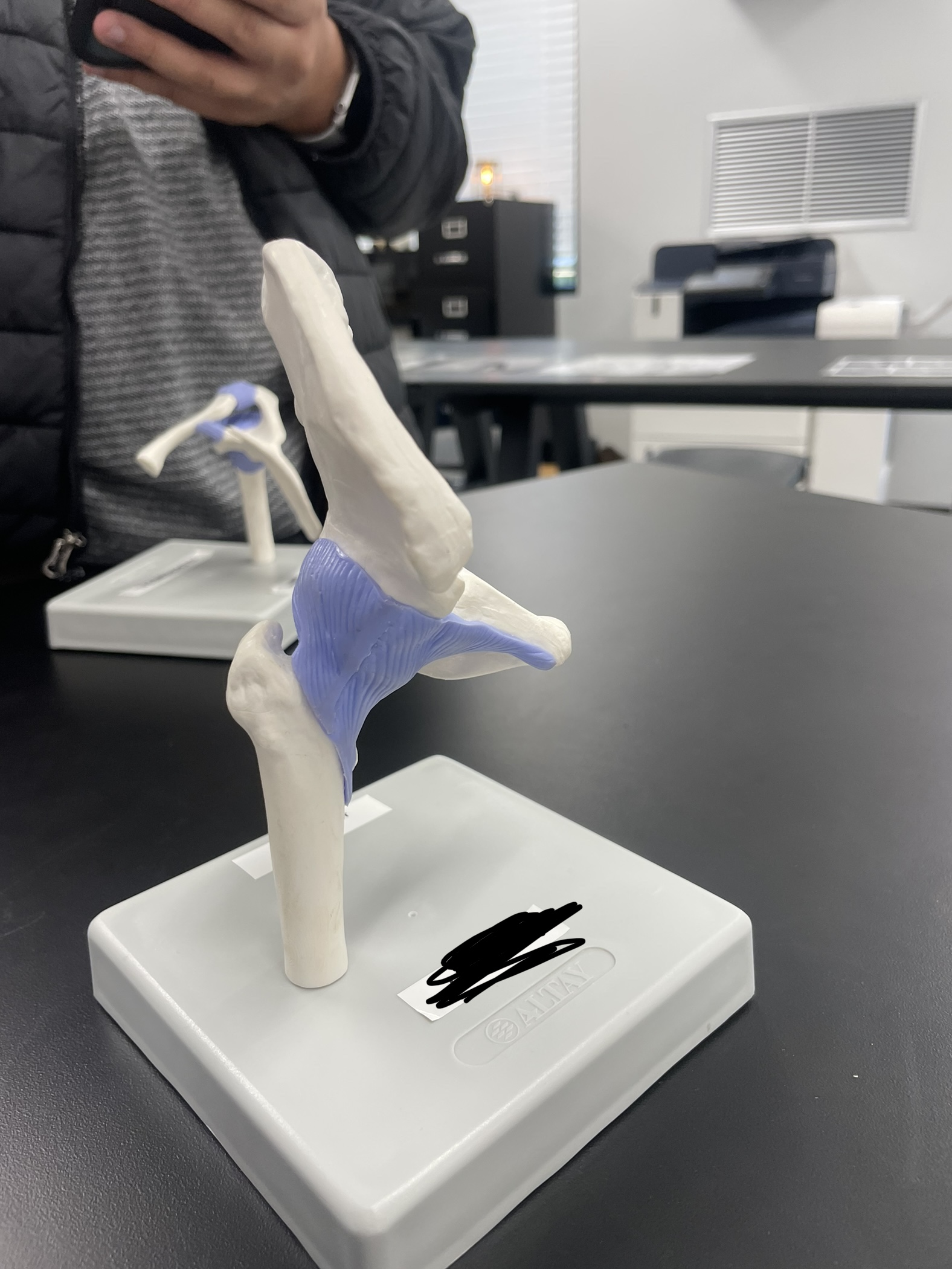 What is the name of this joint