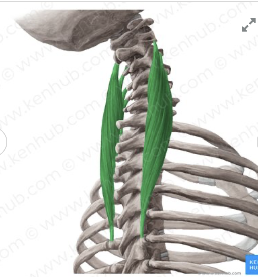 <p><em>table 3, white color, intermediate erector spinae at neck</em></p>