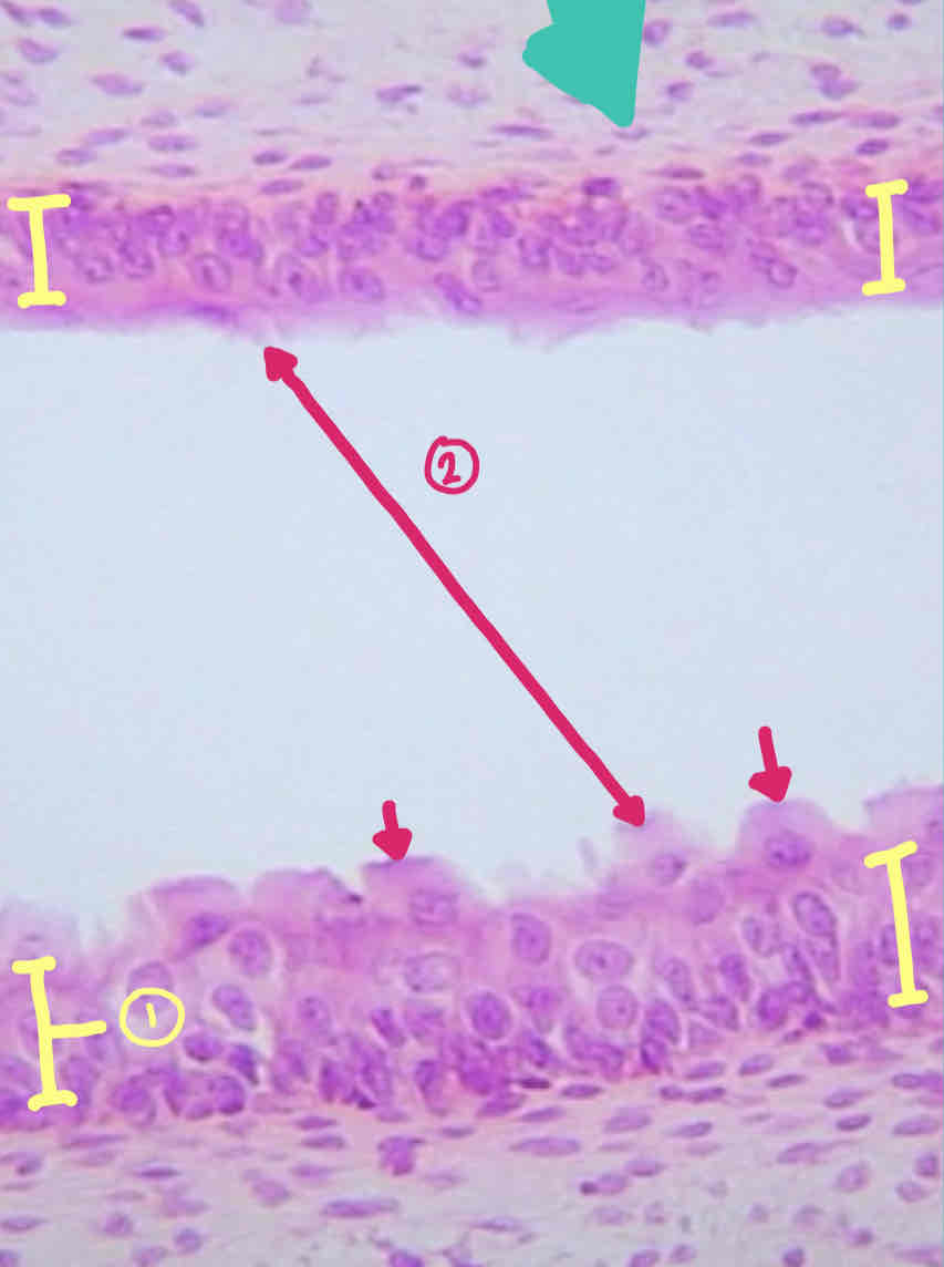 <p>1) Tissue:</p><p style="text-align: start">2) Free Surface Specialization:</p>