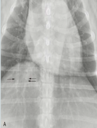 <p>What lung pattern?</p>