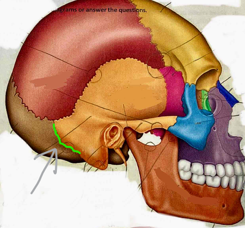 <p>What suture is this?</p>