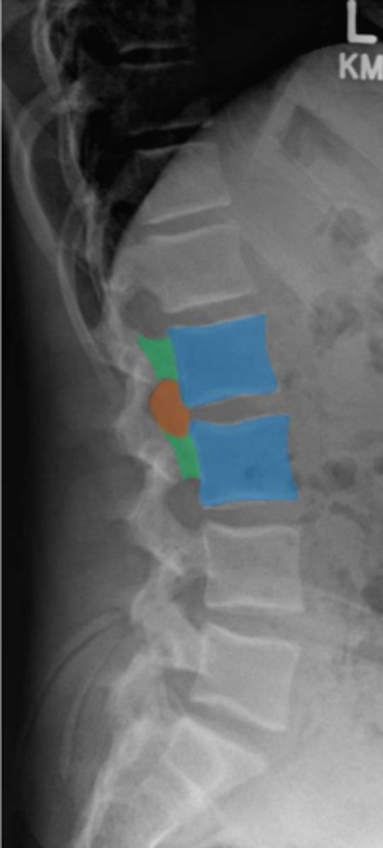 <p>Identify the orange structure</p>