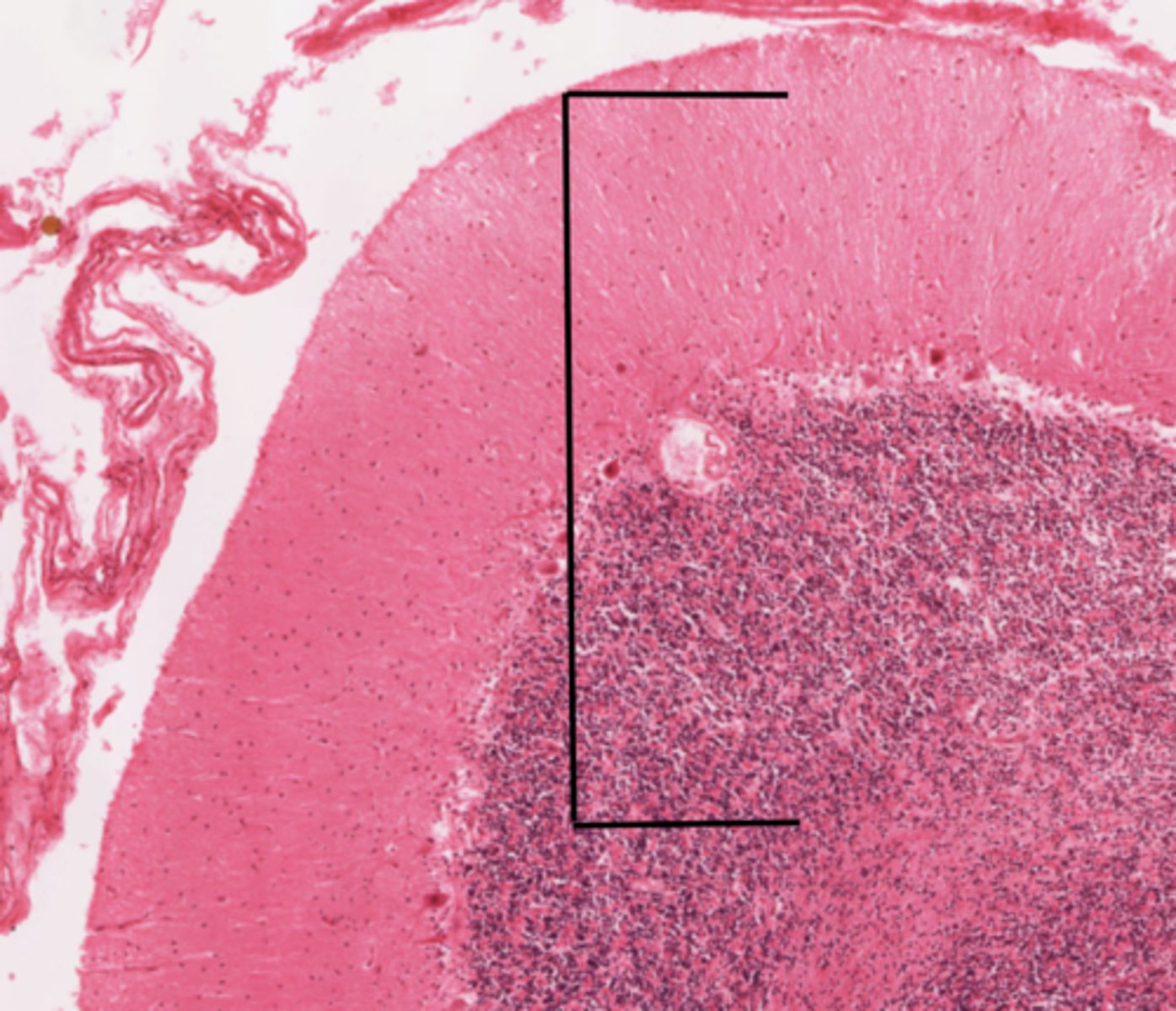 <p>Identify the section of the spinal cord that contains nuclei</p>