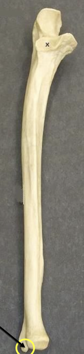 <p>Identify this bone </p>