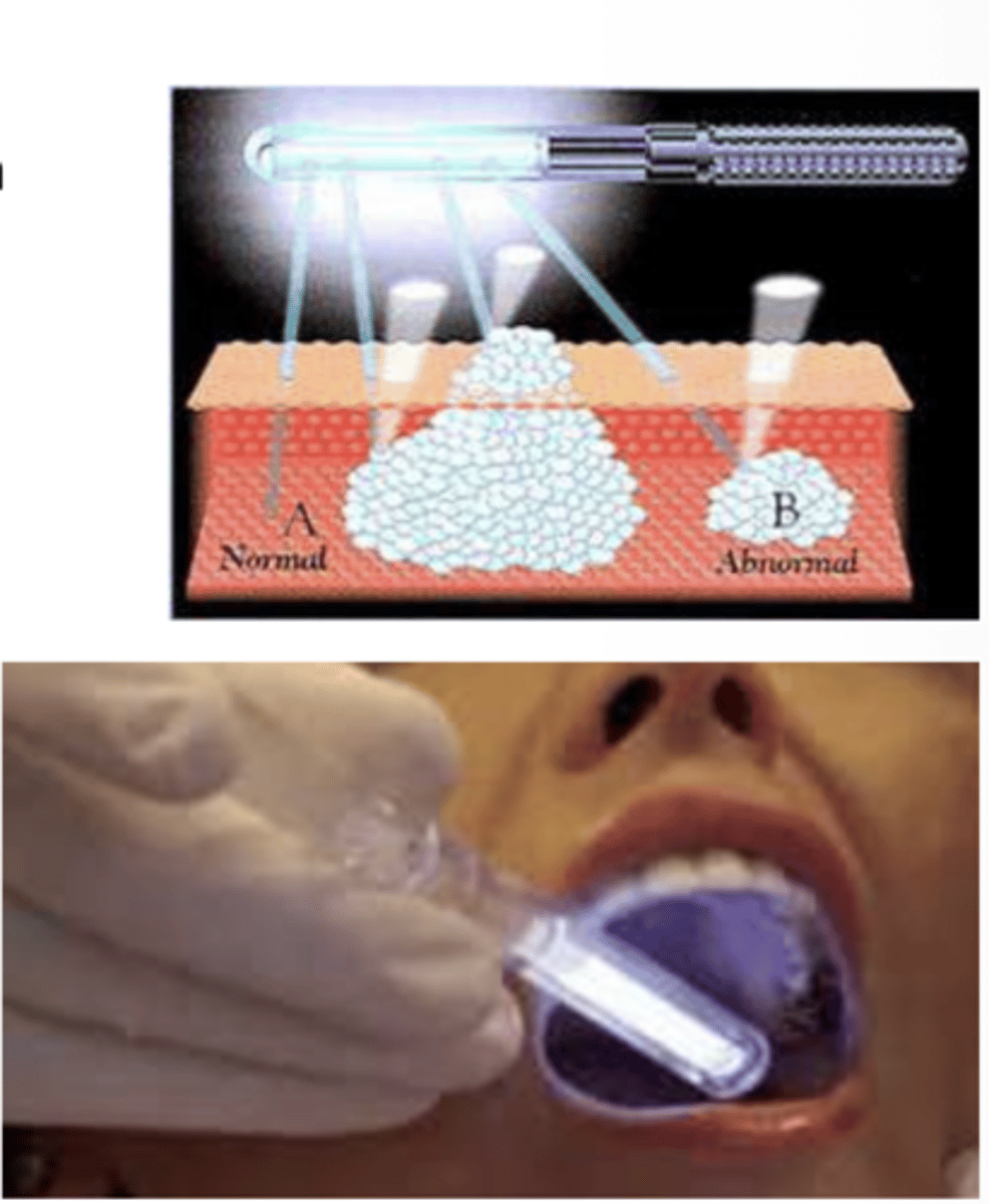 <p>ViziLite</p><p>- acetic acid removes surface debris</p><p>- step 1 = rinse with acetic acid for 1 minute</p><p>- step 2 = darken the room</p><p>- step 3 = activate ViziLIte capsule</p><p>- step 4 = examine the oral cavity</p><p>suspicious lesions appear bright white</p>
