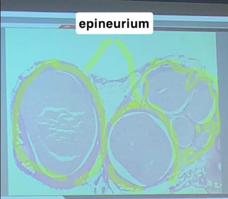 <p>Epineurium</p>