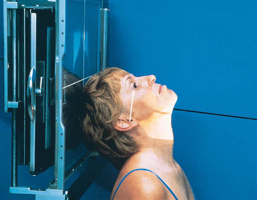 <ul><li><p>patient position:</p><ul><li><p>upright (seated) or supine (torso elevated)</p></li></ul></li><li><p>part position:</p><ul><li><p>hyperextend neck to place IOML parallel as much as possible with IR</p></li><li><p>rest head on vertex</p></li><li><p>MSP perpendicular to IR</p></li></ul></li><li><p>respiration suspended</p></li><li><p>CR:</p><ul><li><p>perpendicular to IOML</p></li><li><p>enters MSP of throat 1 inch posterior to outer canthi</p></li></ul></li><li><p>collimation:</p><ul><li><p>1 inch beyond the lateral sides of the face, superiorly to the chin, and inferiorly to the gonions</p></li><li><p>no larger than 8 × 10 inches</p></li></ul></li></ul><p></p>