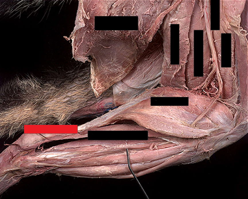 <p>Gastrocnemius muscle</p><p>Superficial Digital Flexor muscle</p><p>Semitendinosus muscle</p><p>Gracilis muscle</p><p>Biceps Femoris muscle</p>