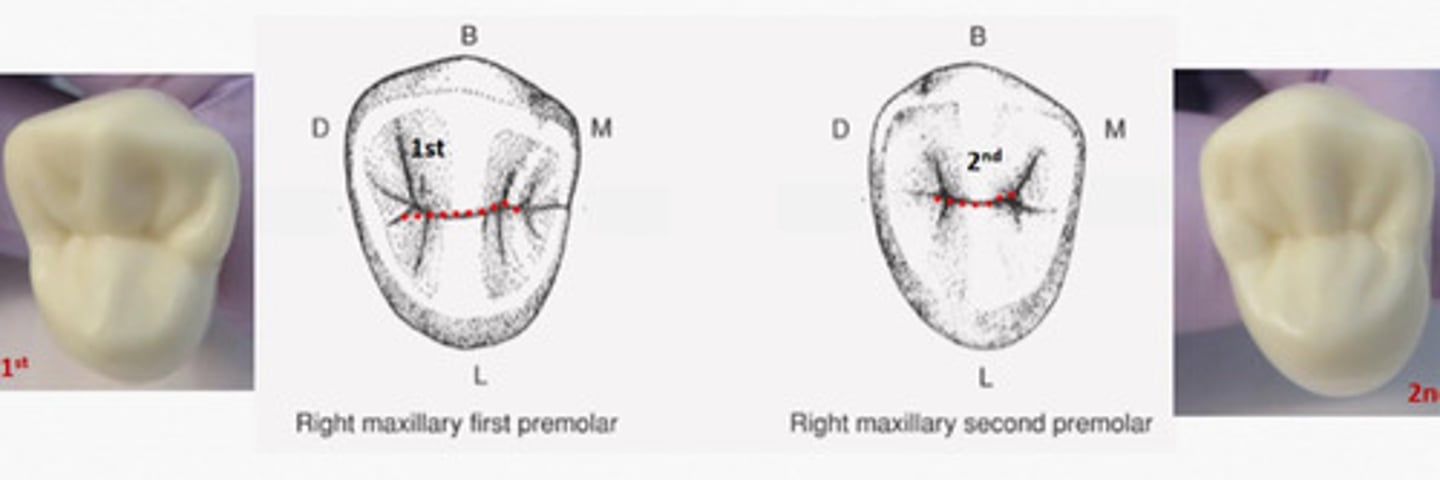 <p>Premolars Possess a __ developmental groove</p>
