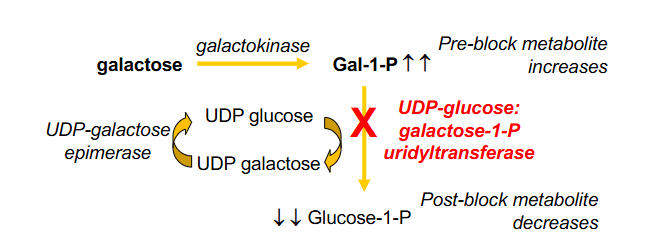 <p>Classical Galactosaemia</p>
