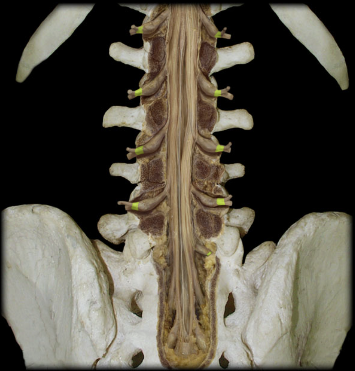 <p>What is the highlighted structure? (yellow)</p>