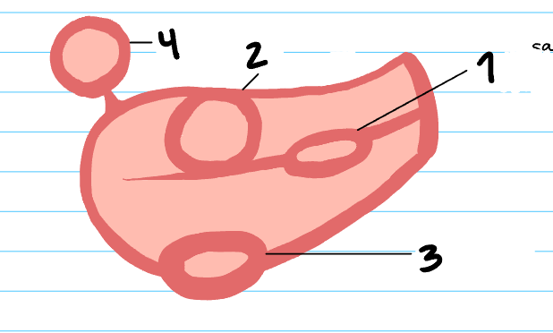 <p>What kind of fibroid is labeled as #4?</p>