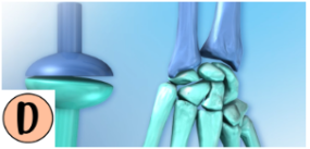 <p>The wrist is a condyloid joint that allows for circumduction, flexion, and extension (radius, and carpal).</p>