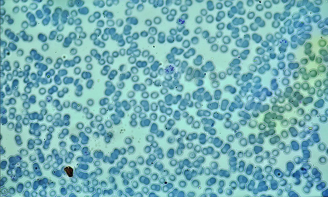 <p><span data-name="microscope" data-type="emoji">🔬</span><span data-name="petri_dish" data-type="emoji">🧫</span><strong><span> </span>Na podstawie zdjęcia preparatu:</strong></p><p></p><ul><li><p><span data-name="book" data-type="emoji">📖</span><span> </span>rozpoznaj gatunek pasożyta;</p></li></ul><p></p><ul><li><p><span data-name="recycle" data-type="emoji">♻</span><span> </span>rozpoznaj wszystkie formy rozwojowe;</p></li></ul><p></p><ul><li><p><span data-name="microbe" data-type="emoji">🦠</span><span> </span>wskaż organelle i cechy charakterystyczne dla danego gatunku;</p></li></ul><p></p><ul><li><p><span data-name="mask" data-type="emoji">😷</span><span> </span>nazwij chorobę, którą pasożyt wywołuje.</p></li></ul><p></p>